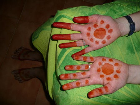 Zo zien mijn handen en voeten er 3 weken lang uit